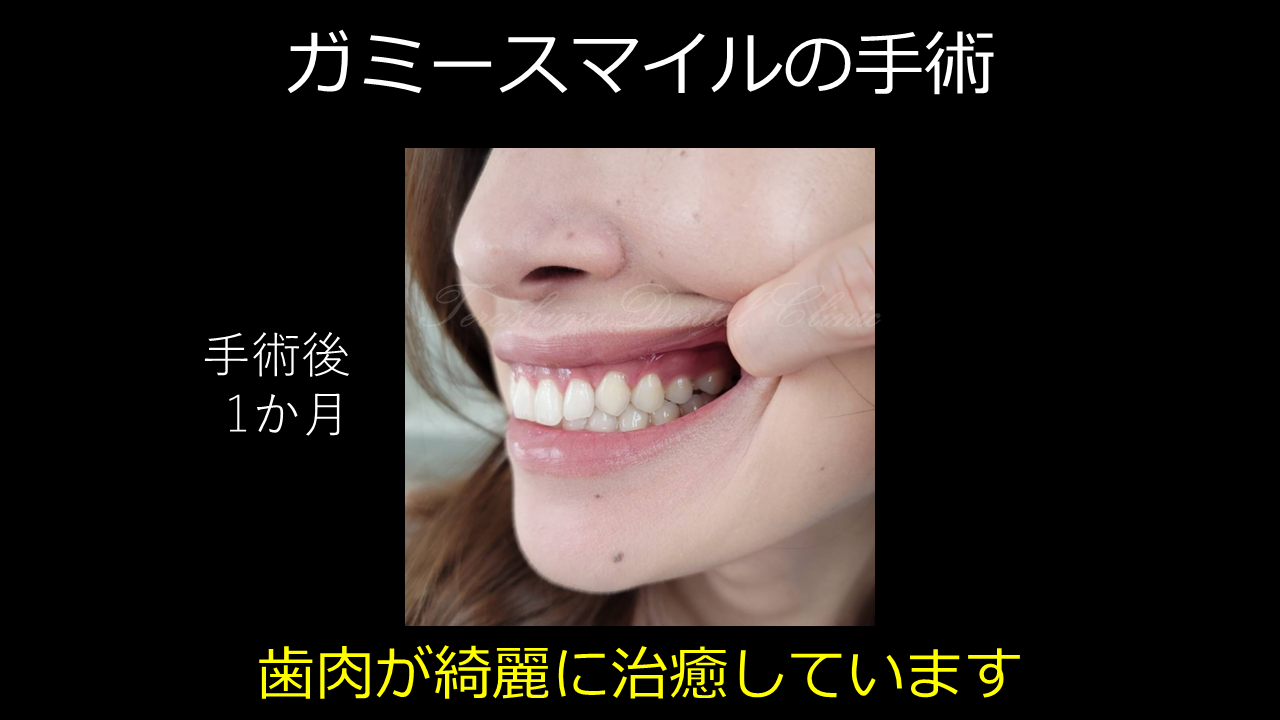 https://mdef.jp/0cb55ec39f5e7d1d50ba9ac6a3d9ce87e5a464e7.PNG