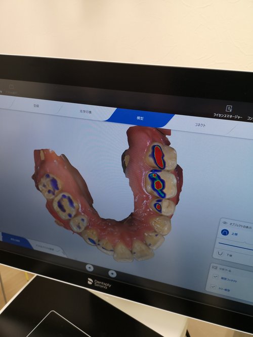デジタル歯科とは？