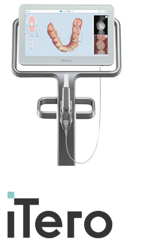 itero(アイテロ)とは？