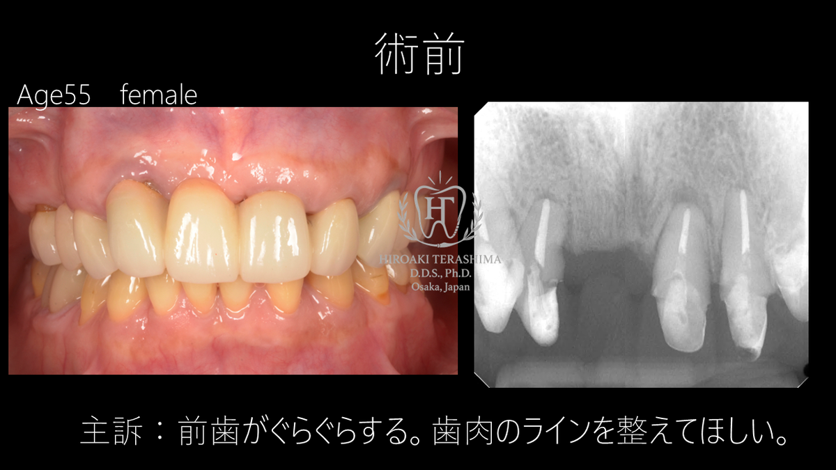 48c22a1c0c2d0083b40f93fe640b91