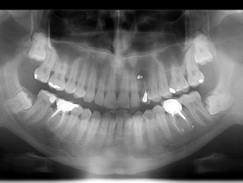 2.歯、歯周の検査